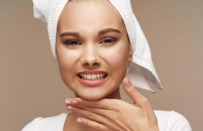 Oily/Acne Prone Skin and Skincare Oils
